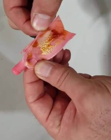 ماساز شمع گوش